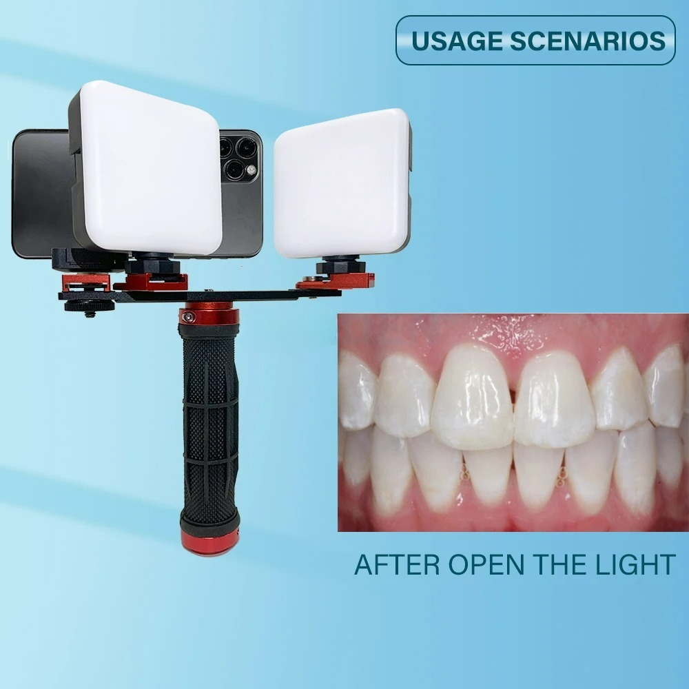ضوء تصوير الأسنان للهاتف مع تق - مراجعة Photography Lighting Accessories وسعره